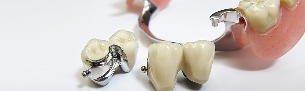 Современные зубные протезы - фото