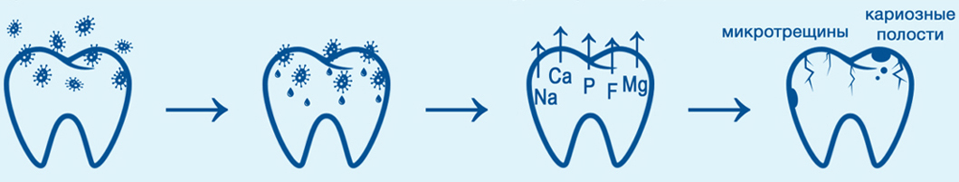 Появление кариеса