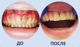 семейный стоматолог плюс орел телефон. Смотреть фото семейный стоматолог плюс орел телефон. Смотреть картинку семейный стоматолог плюс орел телефон. Картинка про семейный стоматолог плюс орел телефон. Фото семейный стоматолог плюс орел телефон