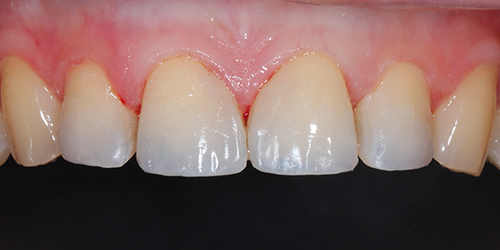 Эстетическая стоматология - фото после