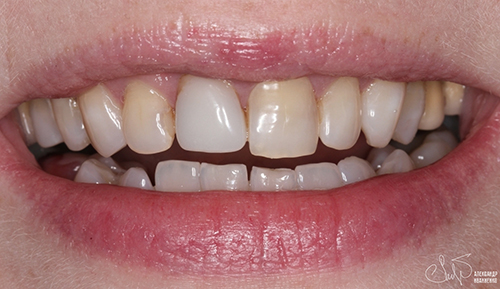 Эстетическая стоматология - фото до
