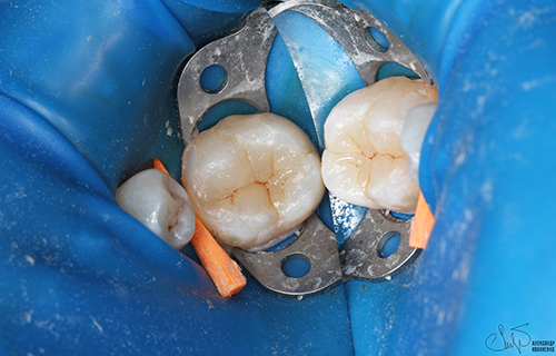 Эстетическая стоматология - фото до