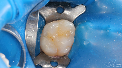 Эстетическая стоматология - фото после